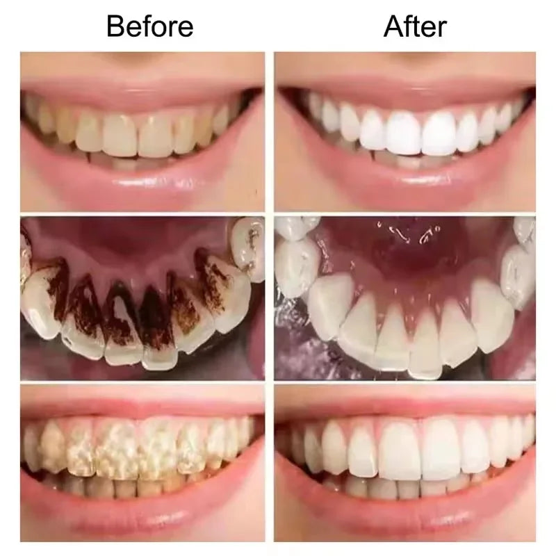 Advanced Color Correcting Teeth Serum