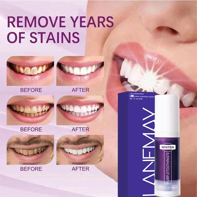 Advanced Color Correcting Teeth Serum